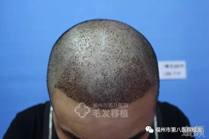 https://img.miyanlife.com/mnt/timg/180321/115J94026-3.jpg