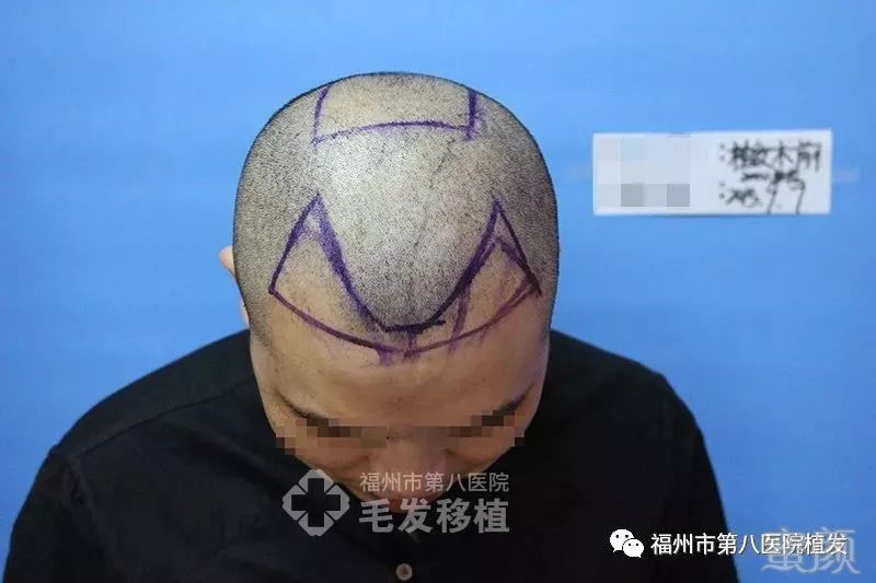 https://img.miyanlife.com/mnt/timg/180321/115J95618-2.jpg