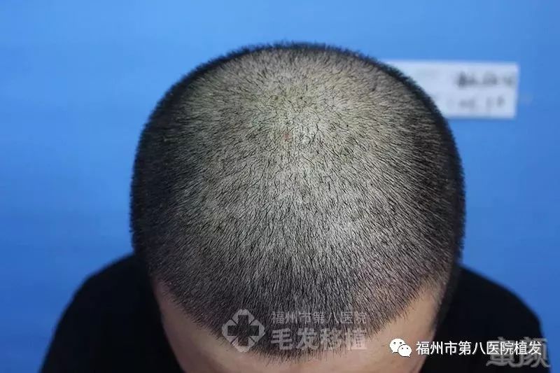 https://img.miyanlife.com/mnt/timg/180321/115K01503-4.jpg
