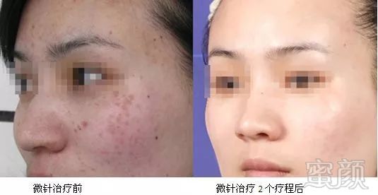 https://img.miyanlife.com/mnt/timg/180321/12022Q349-5.jpg
