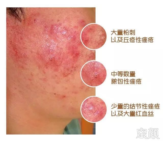 https://img.miyanlife.com/mnt/timg/180321/12022Q362-2.jpg