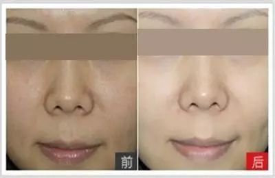 https://img.miyanlife.com/mnt/timg/180321/12022S007-3.jpg