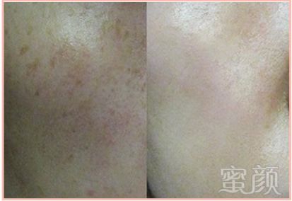 https://img.miyanlife.com/mnt/timg/180321/12022V364-4.jpg