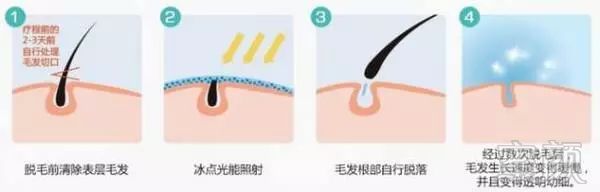 https://img.miyanlife.com/mnt/timg/180321/120334N05-7.jpg
