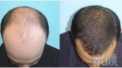 https://img.miyanlife.com/mnt/timg/180321/12103G121-0.jpg