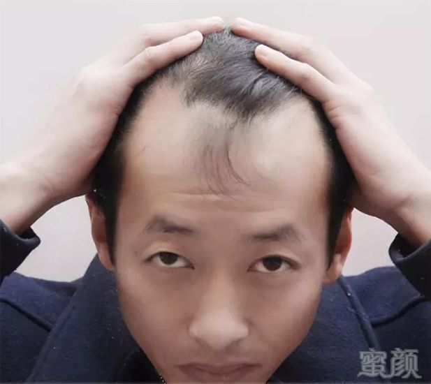 https://img.miyanlife.com/mnt/timg/180321/1213105520-1.jpg