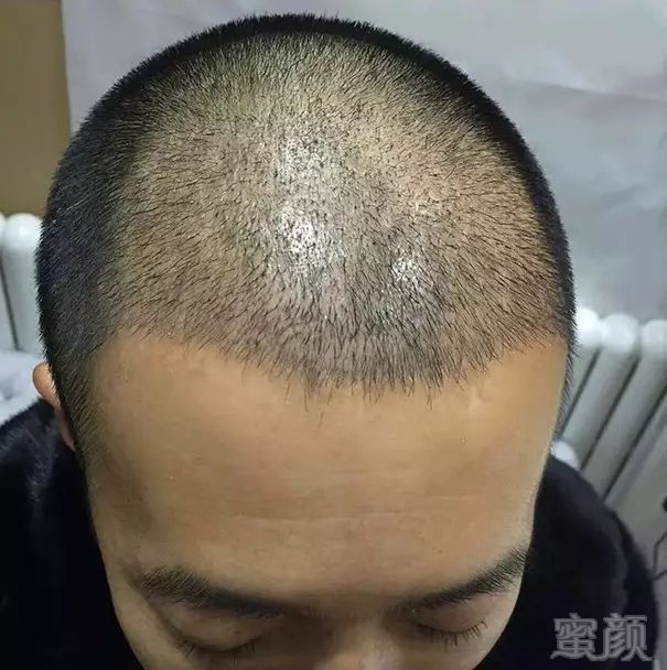 https://img.miyanlife.com/mnt/timg/180321/12131144B-3.jpg