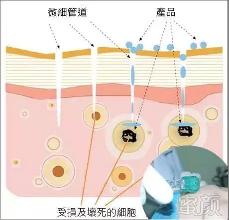 https://img.miyanlife.com/mnt/timg/180321/1220445Y5-3.jpg