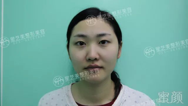 https://img.miyanlife.com/mnt/timg/180321/12222A924-1.jpg