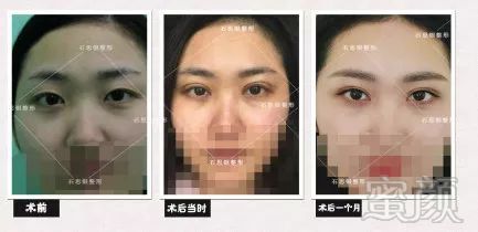 https://img.miyanlife.com/mnt/timg/180321/12222IJ3-3.jpg