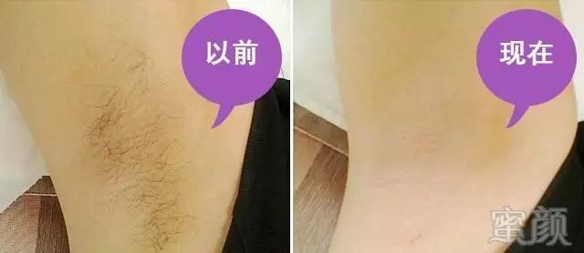 https://img.miyanlife.com/mnt/timg/180321/122J14U2-3.jpg
