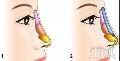 https://img.miyanlife.com/mnt/timg/180321/1231101339-4.jpg
