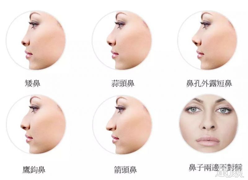 https://img.miyanlife.com/mnt/timg/180321/12311123V-9.jpg