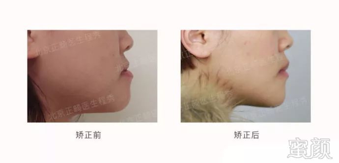 https://img.miyanlife.com/mnt/timg/180321/1243594193-8.jpg