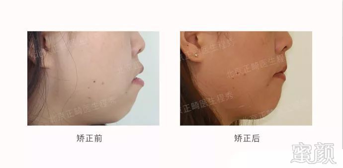 https://img.miyanlife.com/mnt/timg/180321/1244001058-10.jpg