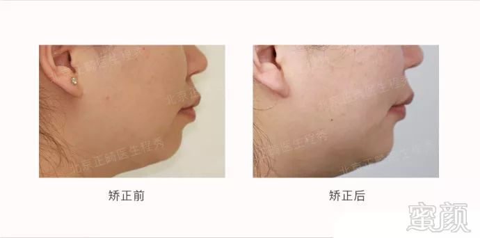 https://img.miyanlife.com/mnt/timg/180321/12440024b-11.jpg