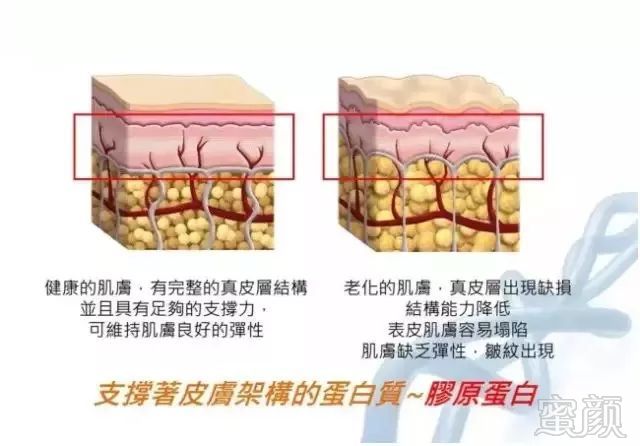 https://img.miyanlife.com/mnt/timg/180321/124Q431O-2.jpg