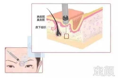https://img.miyanlife.com/mnt/timg/180321/131GR312-0.jpg