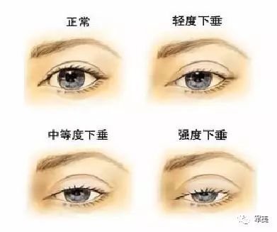 https://img.miyanlife.com/mnt/timg/180321/131GWK4-1.jpg