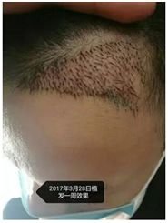 https://img.miyanlife.com/mnt/timg/180322/104H23224-5.jpg