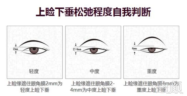 https://img.miyanlife.com/mnt/timg/180322/1052402251-11.jpg