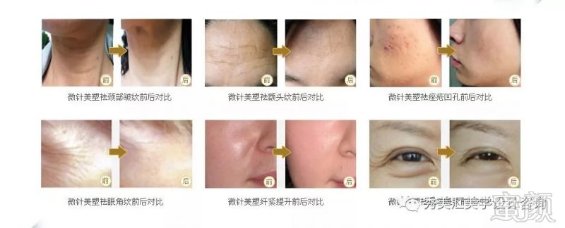 https://img.miyanlife.com/mnt/timg/180322/1303092096-4.jpg