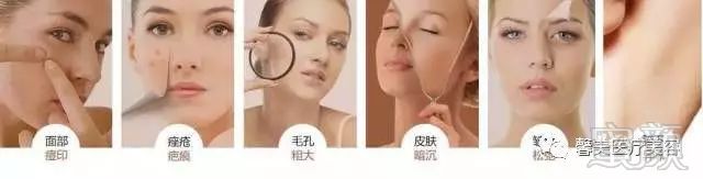 https://img.miyanlife.com/mnt/timg/180322/1304452193-0.jpg