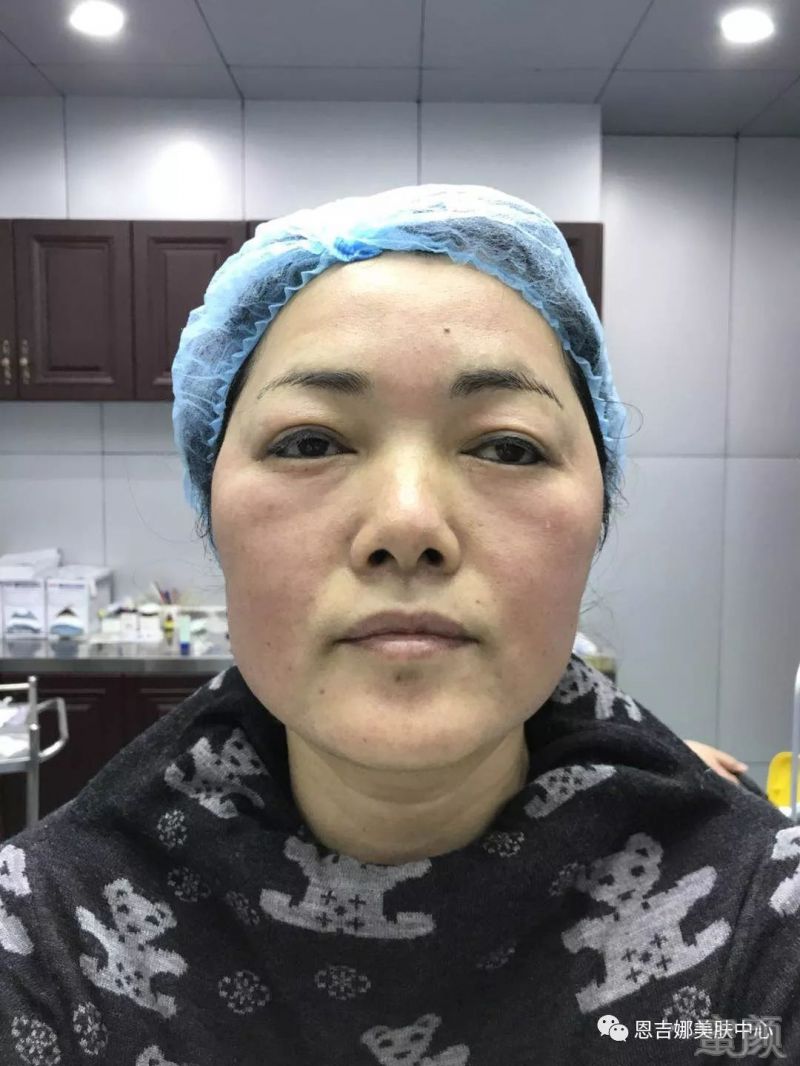 https://img.miyanlife.com/mnt/timg/180322/1304494944-9.jpg
