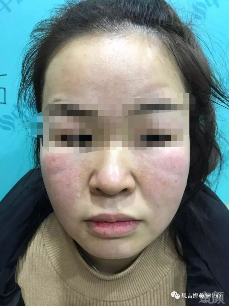 https://img.miyanlife.com/mnt/timg/180322/13044I5C-7.jpg