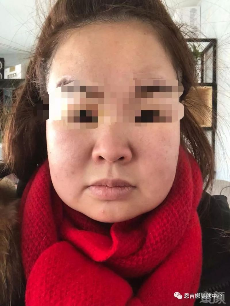 https://img.miyanlife.com/mnt/timg/180322/13044MP5-6.jpg