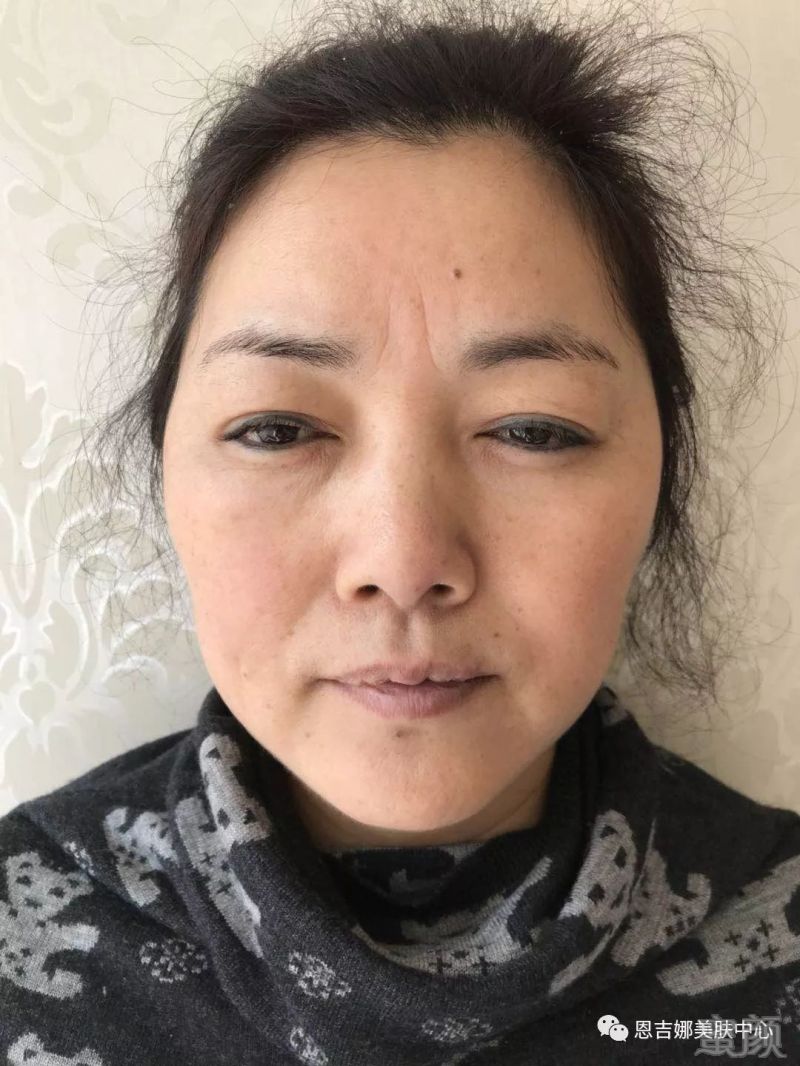 https://img.miyanlife.com/mnt/timg/180322/13044R215-8.jpg