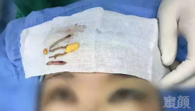https://img.miyanlife.com/mnt/timg/180322/130HTX7-0.jpg