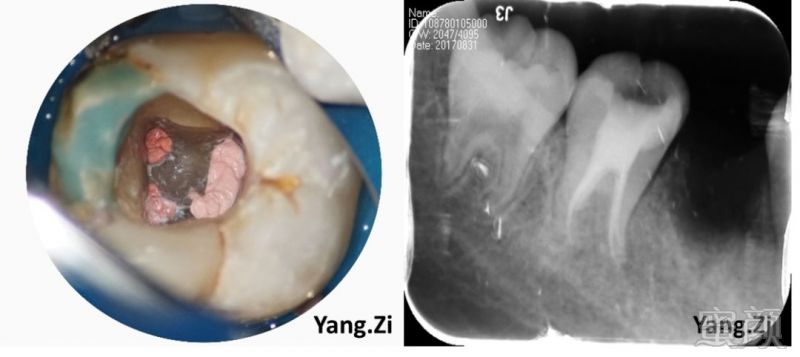 https://img.miyanlife.com/mnt/timg/180322/130Qa104-4.jpg