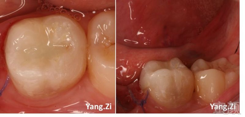 https://img.miyanlife.com/mnt/timg/180322/130R03N6-5.jpg