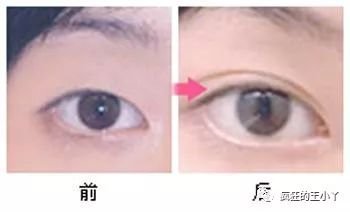 https://img.miyanlife.com/mnt/timg/180322/1315515419-2.jpg