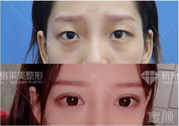 https://img.miyanlife.com/mnt/timg/180322/134004BB-7.jpg
