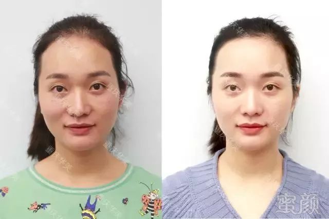 https://img.miyanlife.com/mnt/timg/180322/13444U046-5.jpg