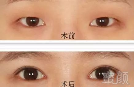 https://img.miyanlife.com/mnt/timg/180322/1351464100-10.jpg