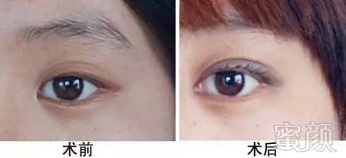 https://img.miyanlife.com/mnt/timg/180322/13514BO1-11.jpg