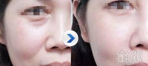 https://img.miyanlife.com/mnt/timg/180323/11215BV2-7.jpg