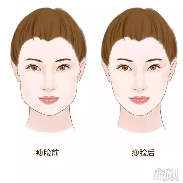 https://img.miyanlife.com/mnt/timg/180323/11232L318-5.jpg