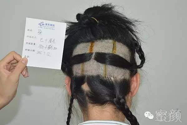 https://img.miyanlife.com/mnt/timg/180323/1209513G8-2.jpg