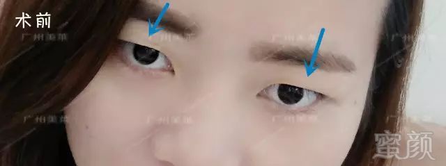https://img.miyanlife.com/mnt/timg/180323/1223544137-0.jpg