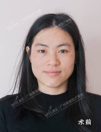 https://img.miyanlife.com/mnt/timg/180323/12235WI7-2.jpg