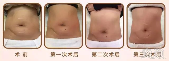 https://img.miyanlife.com/mnt/timg/180323/12451SN1-15.jpg