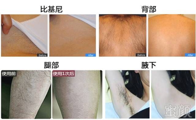 https://img.miyanlife.com/mnt/timg/180323/130H51Q3-4.jpg