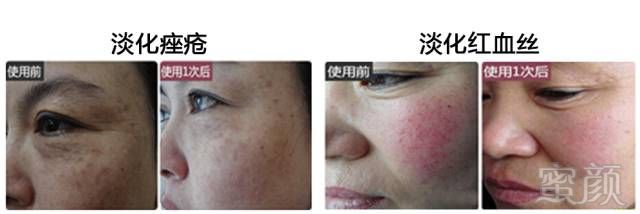 https://img.miyanlife.com/mnt/timg/180323/130H615H-8.jpg