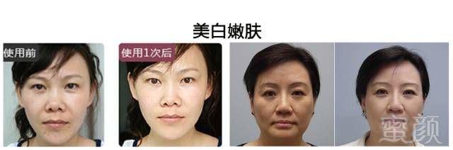 https://img.miyanlife.com/mnt/timg/180323/130HB1G-7.jpg