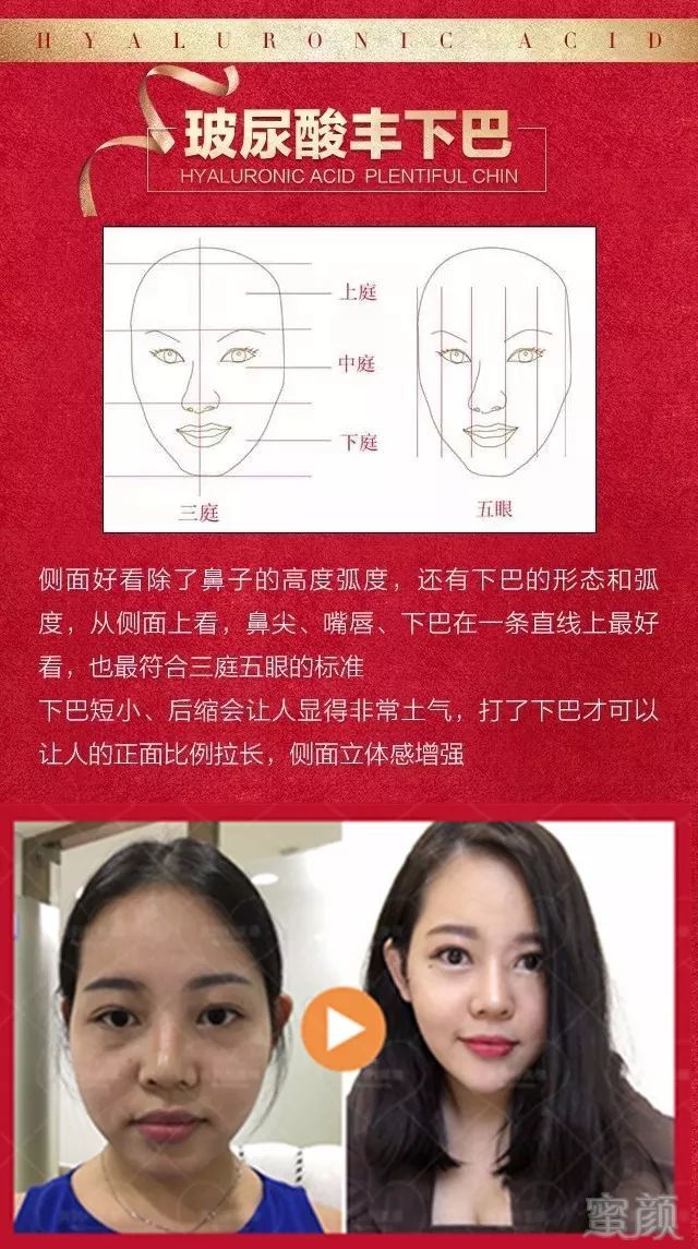 案例图片