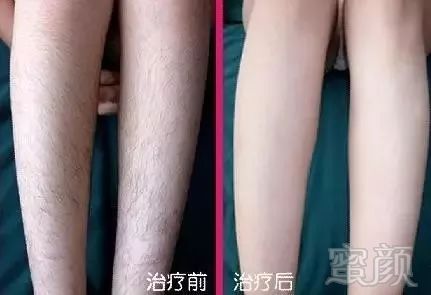 https://img.miyanlife.com/mnt/timg/180323/1320042451-16.jpg